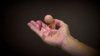 Fetus 3D